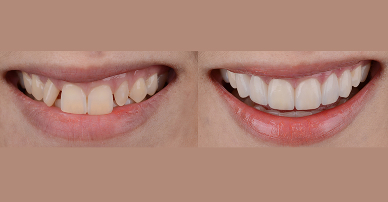 Cosmetic Dentistry