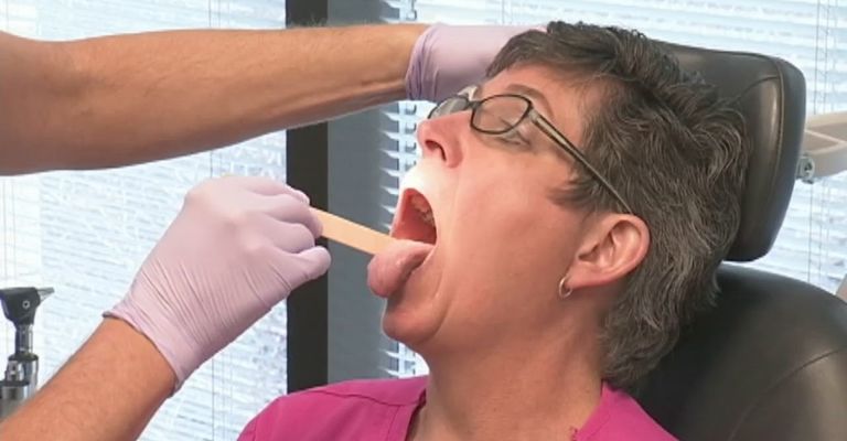 Oral cancer